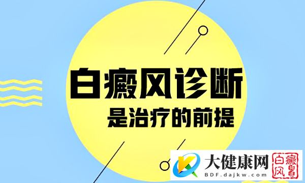 白癜风会引发哪些常见病?