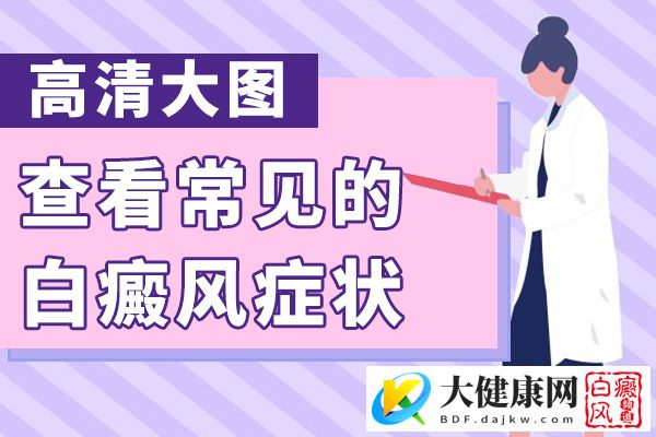 白癜风扩散有哪些症状呢?