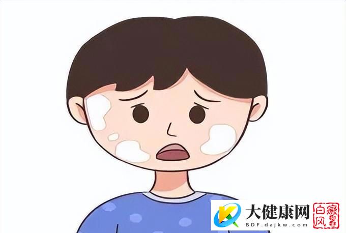 免疫力低下的白癜风患者，日常饮食中可以吃这5种食物